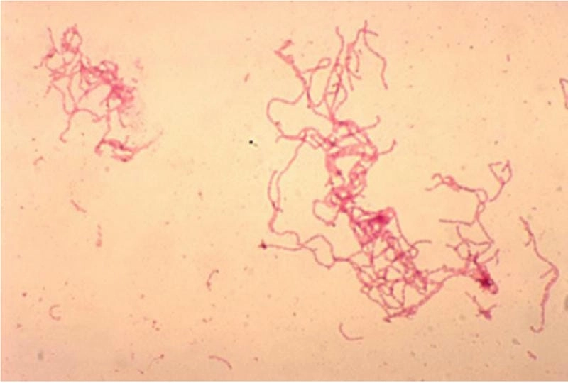 Chi tiết tổn thương da ở ảnh bị bệnh hạ cam