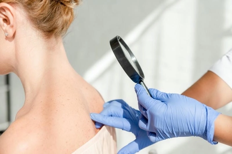 Tìm hiểu hồng ban đa dạng có nguy hiểm không để phòng tránh