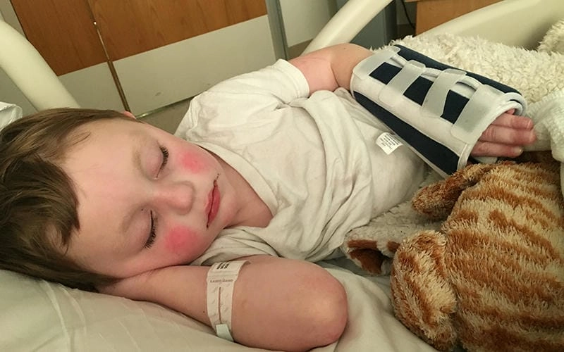 Loạt ảnh minh họa điều trị kawasaki theo y khoa