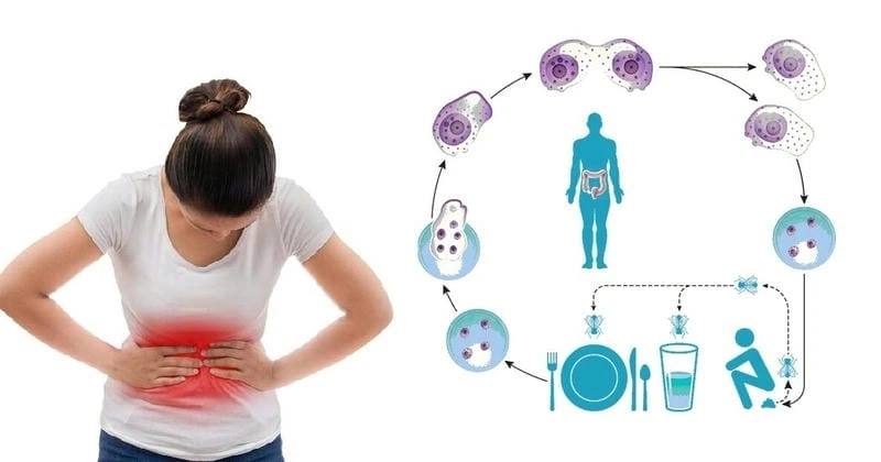 Tác động của bệnh kiết lị ảnh hưởng đến sức khỏe