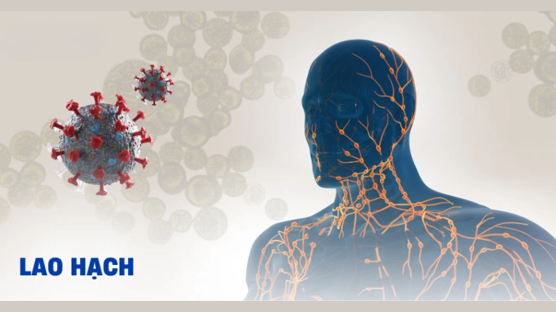 Hình ảnh bệnh lao hạch gây sốc thế nào