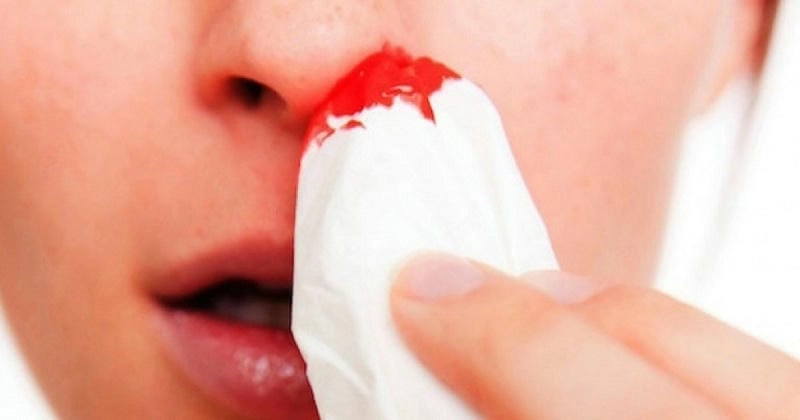 Bật mí loạt ảnh bệnh máu khó đông rùng rợn