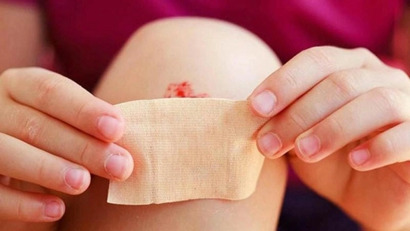 Gây sốc với những ảnh bị máu khó đông hiếm gặp