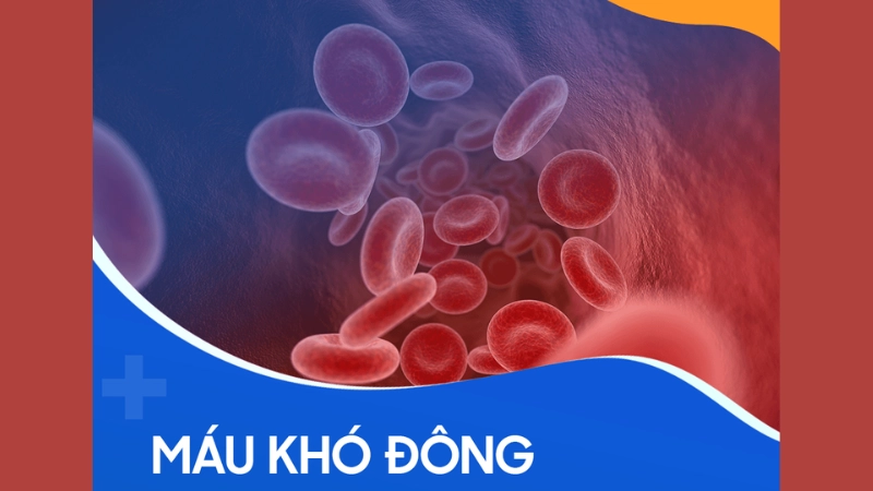 Bệnh máu khó đông là như thế nào khiến ai cũng bàng hoàng