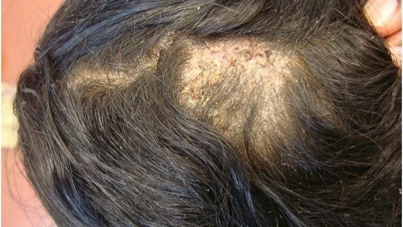 Lưu ý khi thấy hình ảnh nấm đầu ngón tay lạ