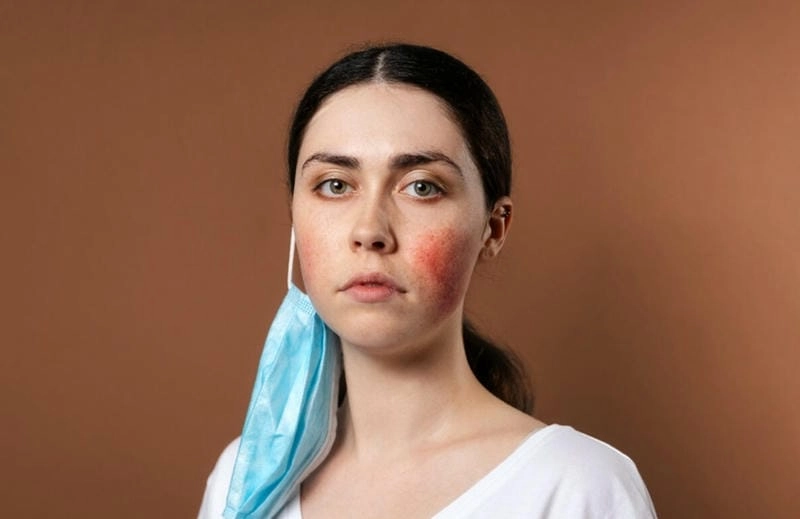 Nhận biết sớm dấu hiệu bệnh nấm da mặt