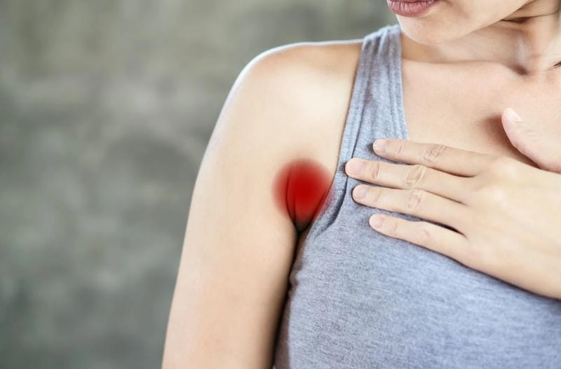 Chia sẻ hiệu quả về cách chữa bệnh ổ gà ở nách tại nhà