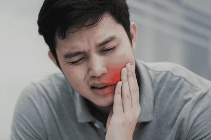 Khám phá hình ảnh bệnh quai bị ở trẻ em dễ hiểu