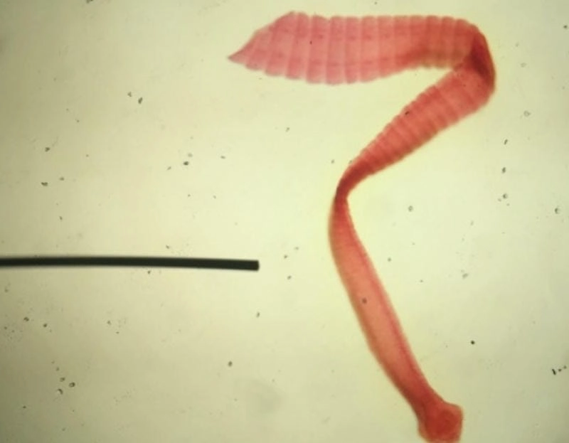 Hình sán chó dưới kính hiển vi chi tiết cấu tạo rõ ràng