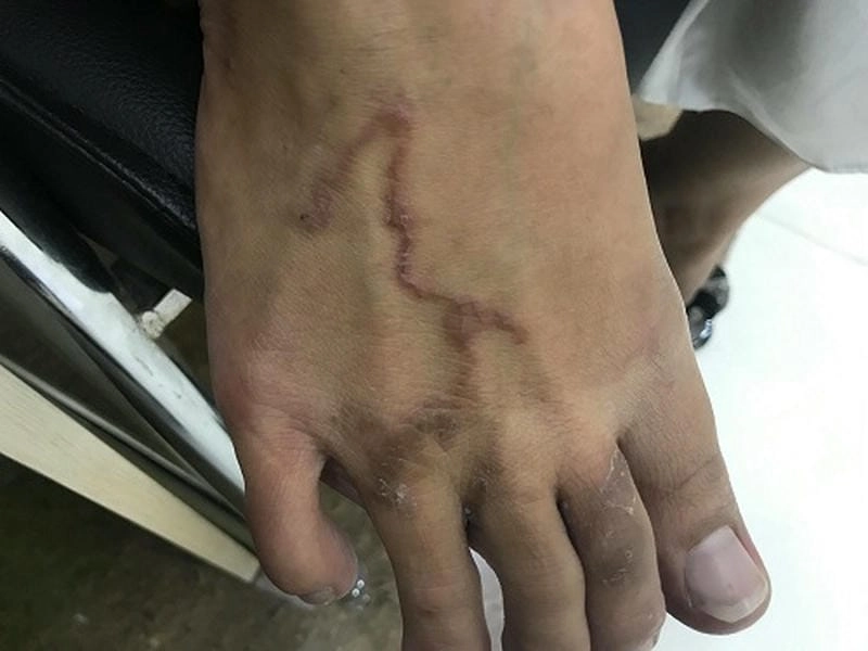 Hình sán chó rõ nét mô tả cấu trúc và hình thể từng đốt