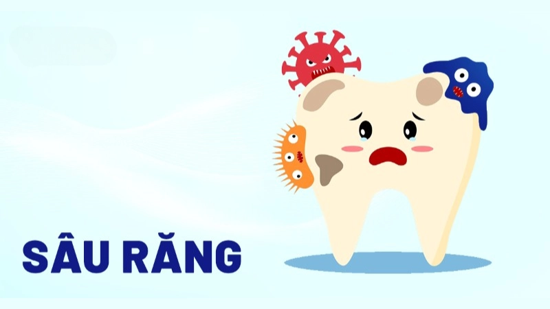 Hình ảnh bệnh sâu răng là như thế nào 
