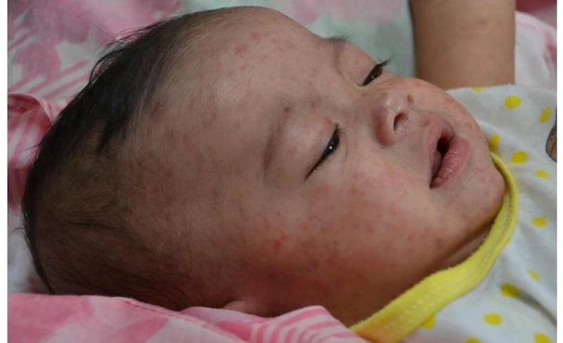 Hình ảnh con muỗi gây sốt xuất huyết giúp nâng cao cảnh giác