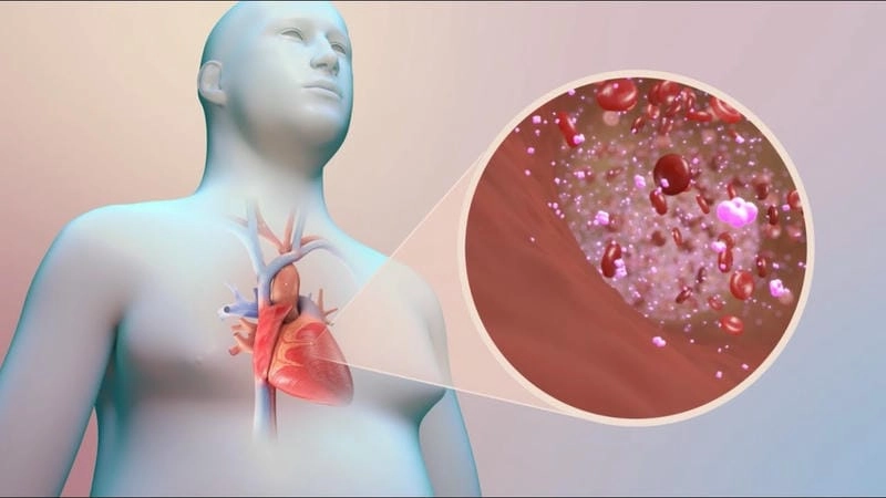 Nhìn rõ cao huyết áp ảnh hưởng đến tim ra sao