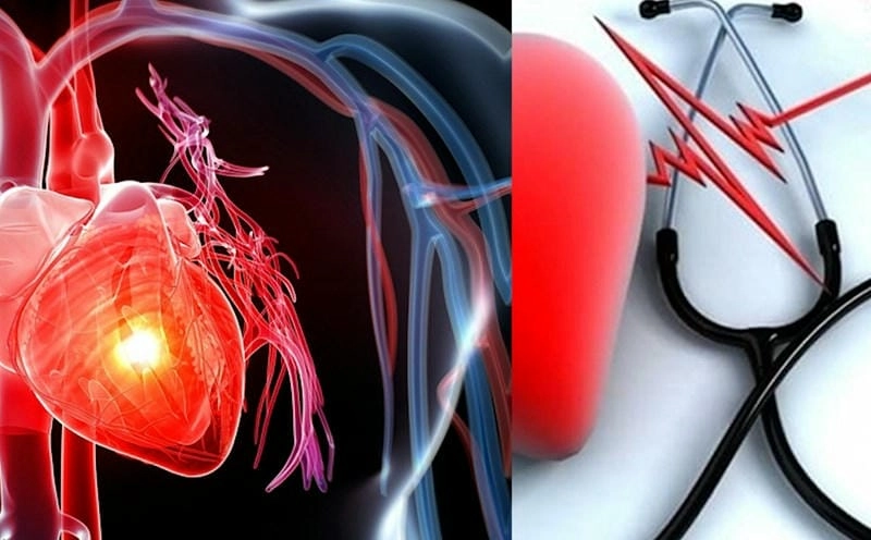 Tìm hiểu sâu về hình ảnh bệnh tim mạch thường gặp