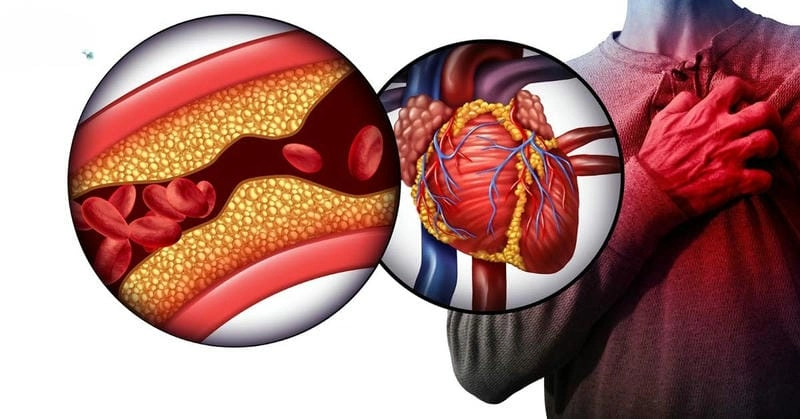 Khám phá các hình ảnh thuốc trợ tim thông dụng