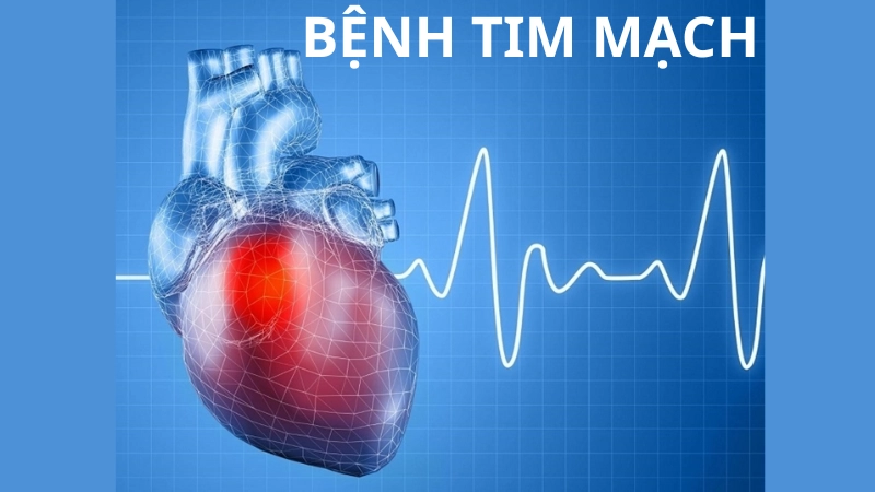 Hình ảnh bệnh tim mạch là như thế nào