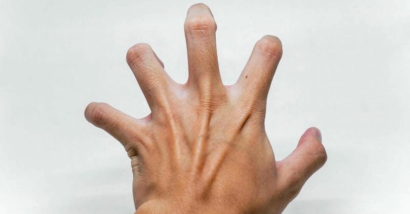 Giải đáp bệnh uốn ván có chữa khỏi không chính xác