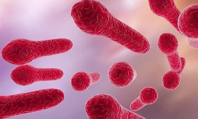 Tổng hợp hình ảnh bệnh uốn ván nặng thực tế