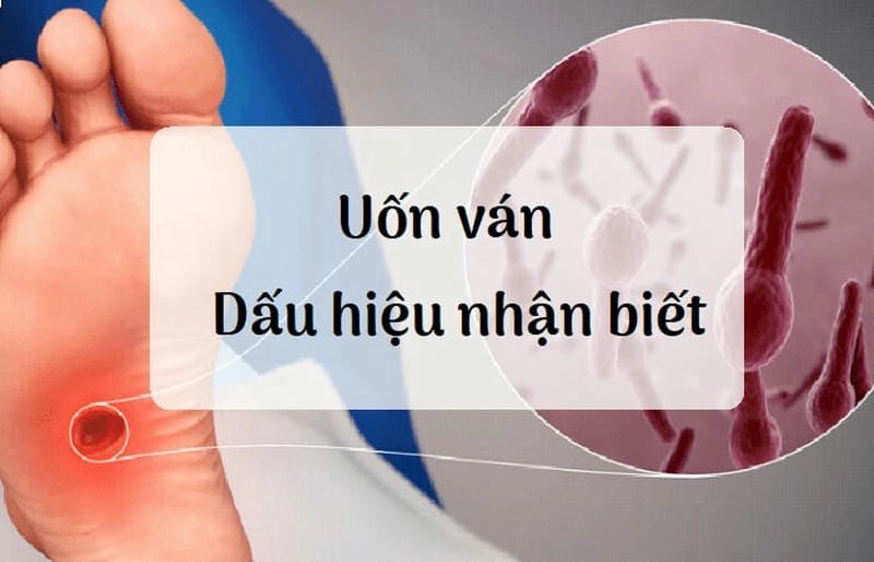 Kho tư liệu hình ảnh uốn ván đầy đủ và chi tiết