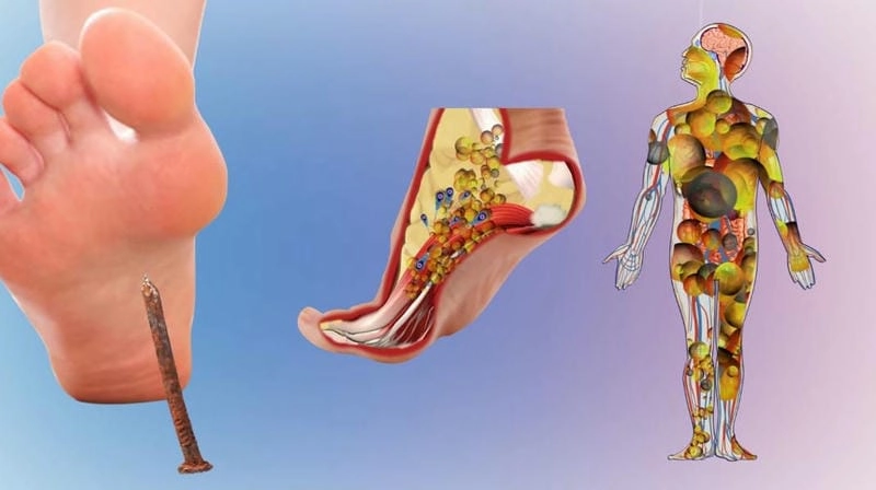 Lưu ý biểu hiện sau tiêm uốn ván bầu bất thường