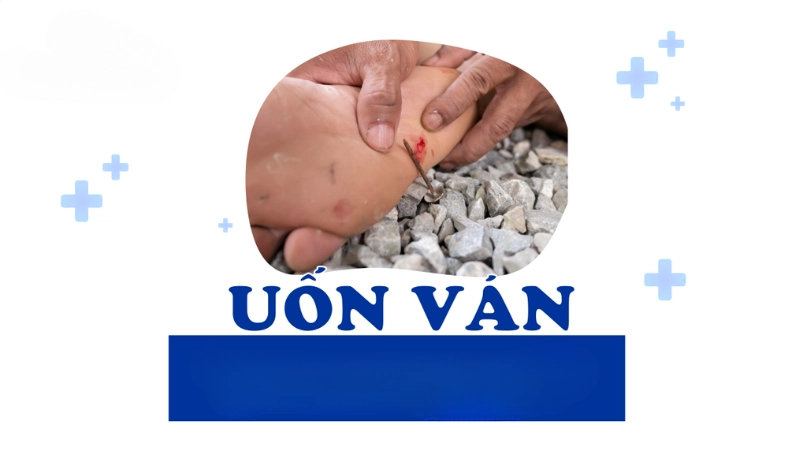 Hình ảnh bệnh uốn ván là như thế nào