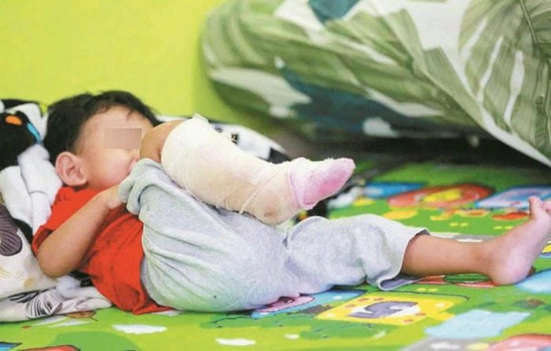 Cảnh báo hình ảnh người bị bệnh vi khuẩn ăn thịt người đang lan nhanh