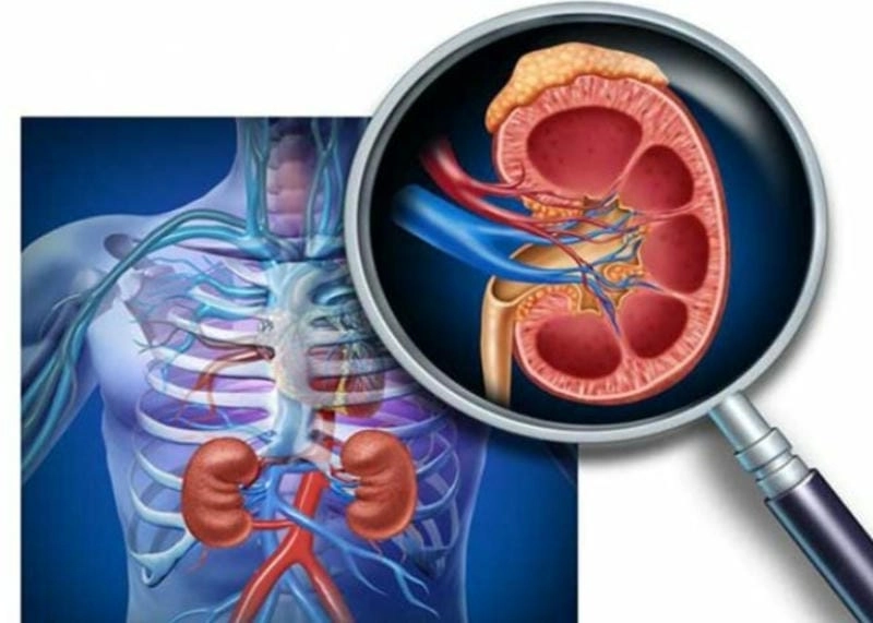 Khám phá hình ảnh bệnh viêm cầu thận chi tiết thực tế