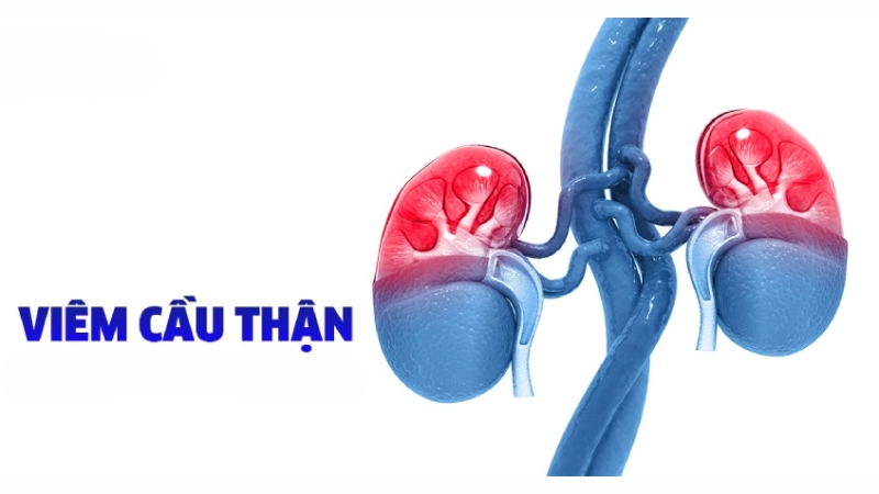 Hình ảnh bệnh viêm cầu thận là như thế nào