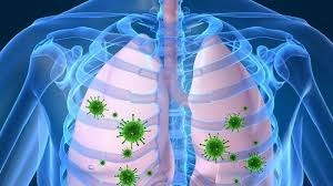 Tìm hiểu đầy đủ triệu chứng viêm phổi ở người già