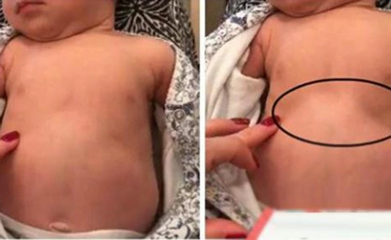 Tìm hiểu hình ảnh thực tế về người bị bệnh phổi