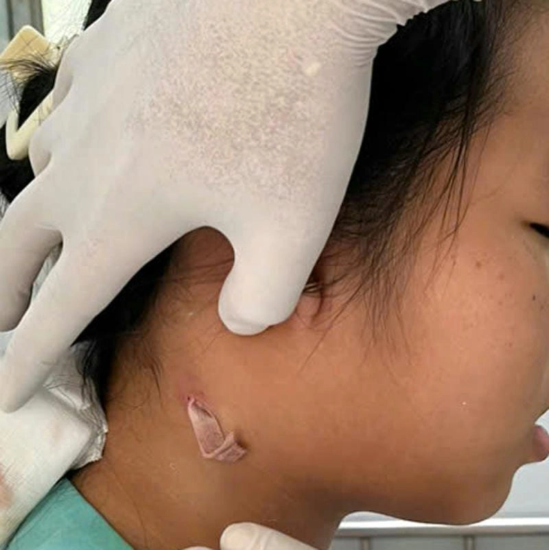 Cập nhật thông tin whitmore đầy đủ cho người tìm hiểu