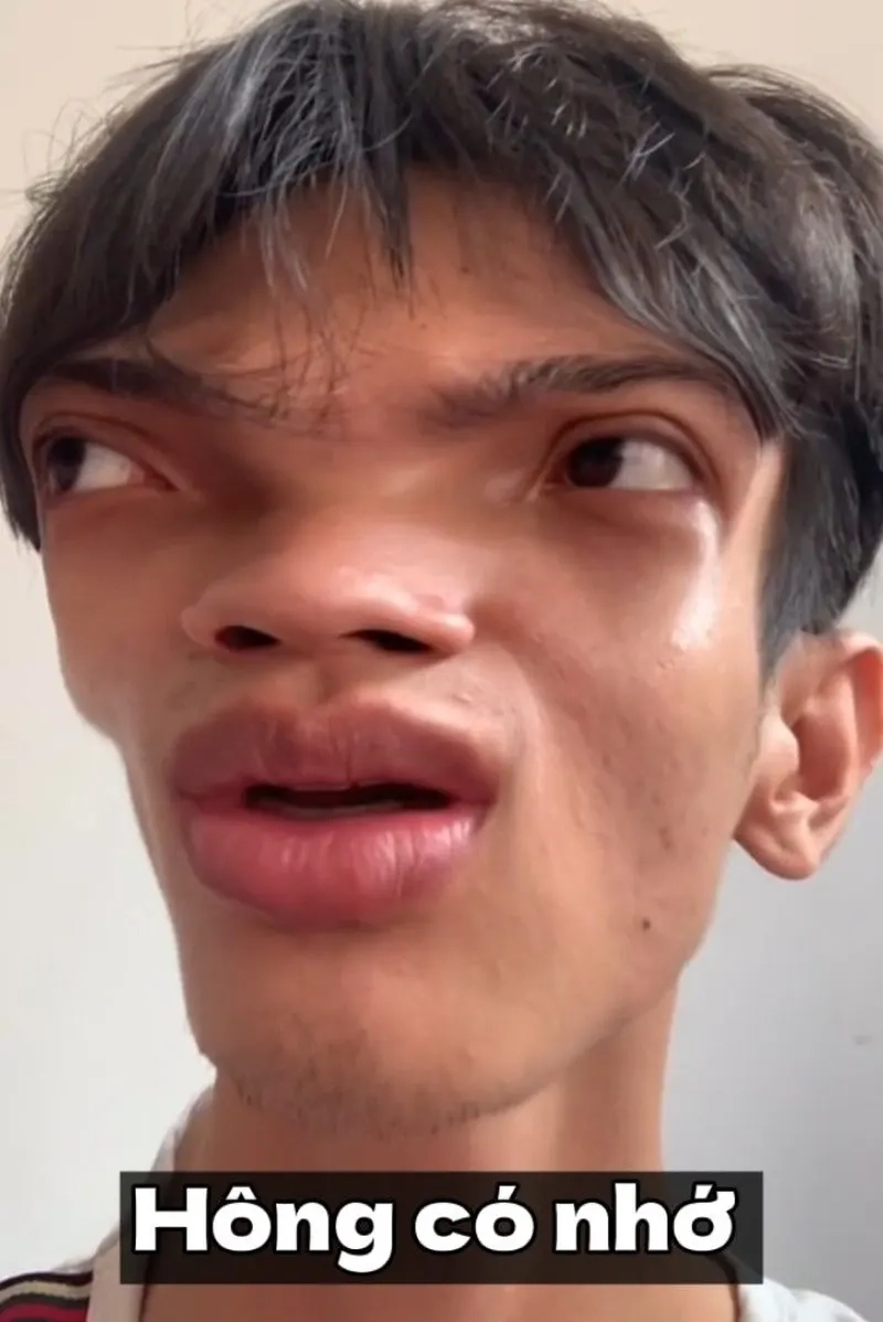 Tấu hài không trượt phát nào với meme tấu hài viral!