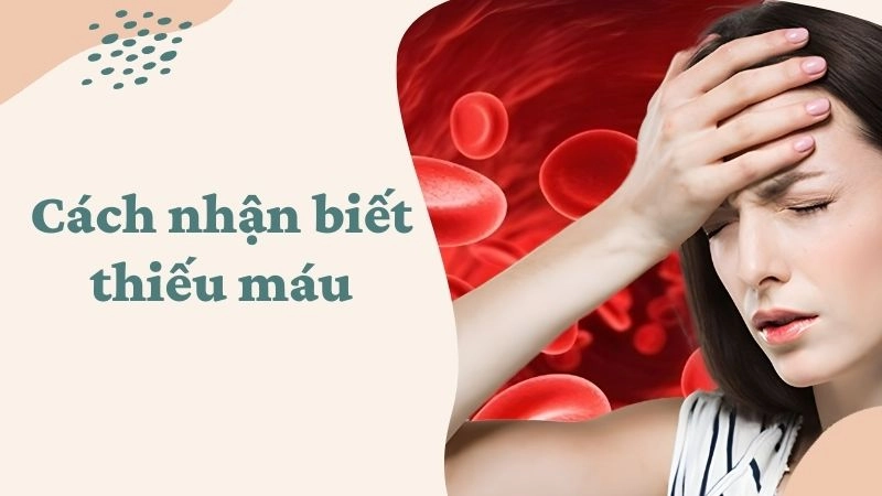 Da xanh xao, niêm mạc nhợt – dấu hiệu “kinh điển” nhưng dễ bỏ qua